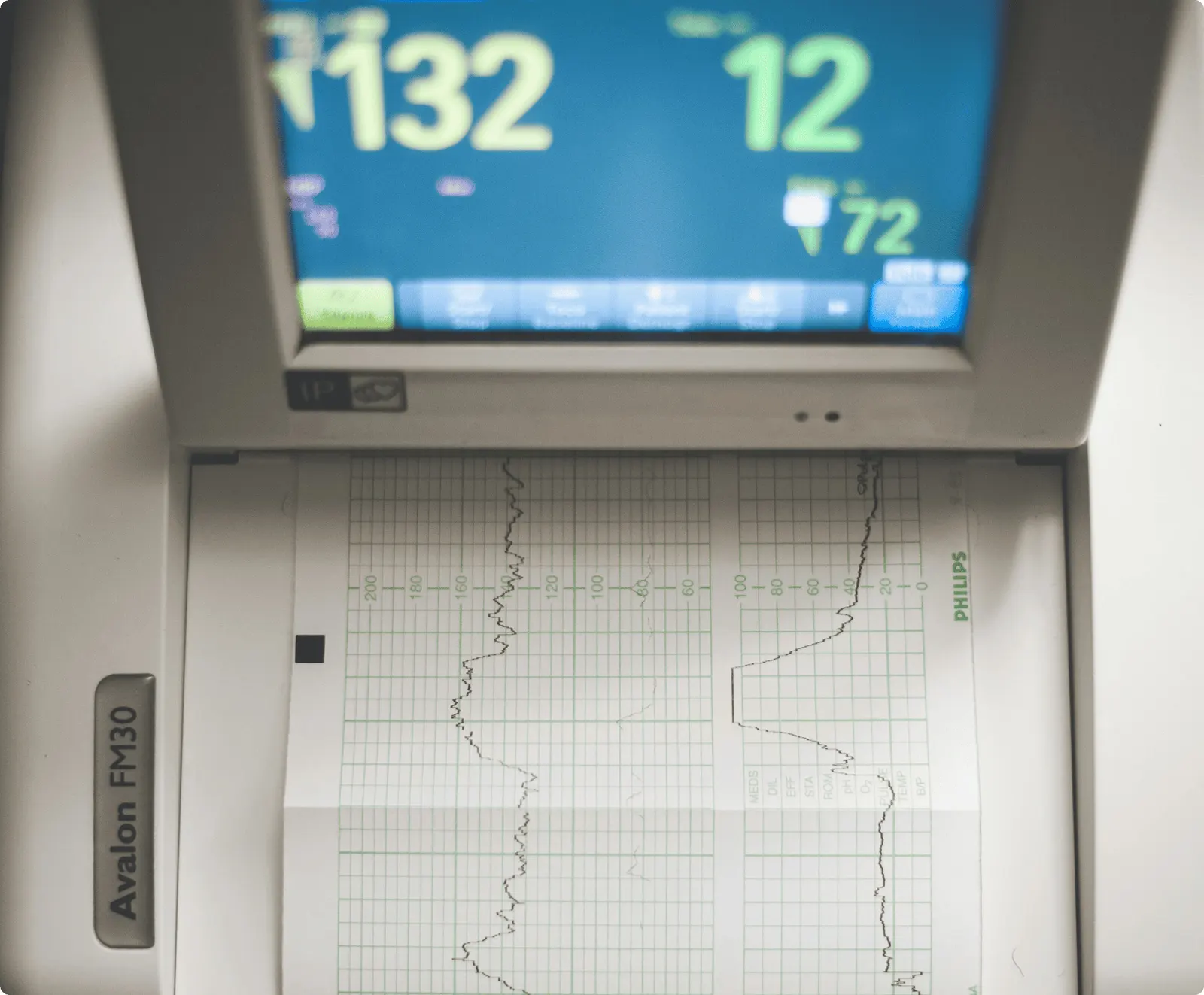 Cardiología Intensiva